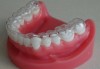 Zirconia Crown Zirconia Teeth Zirconia Denture