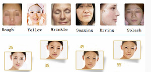 AYJ-T29B(CE) New Product Distributor Wanted Thermagic Machine For Anti Wrinkle,Face Lifting,Skin Rejuvenation