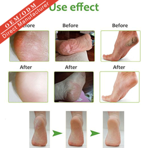 OEM korea natural organic olive oil dead skin removal moisturizing peeling foot mask
