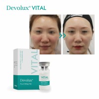 Devolux Vital new liquid poly-l-lactic acid plla medical products for facial rejuvenation