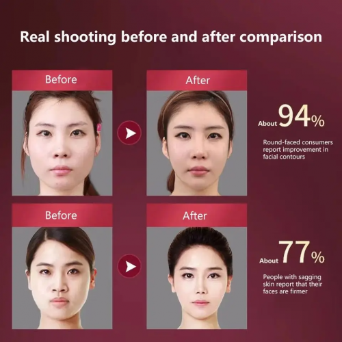 LED Photon Therapy Facial Slimming Vibration Massager Heated Facial Lifting Device Double Chin V Face Care Tool