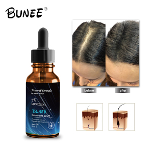 50ml OEM Hair Growth Treatment Hairs Care Biotin  Hair serum