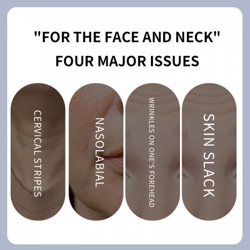 Electric Neck Beauty Instrument To Reduce Neck Wrinkles, Nasolabial Fold Care and Beauty EMS Micro-current Massager