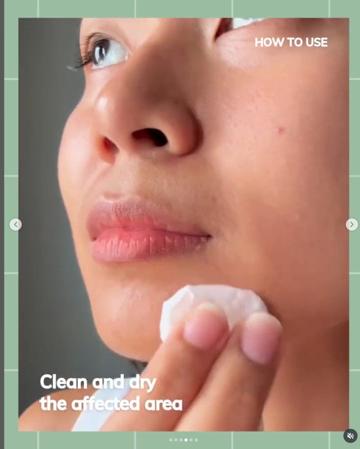 ACNE CLEAR SPOT TREATMENT