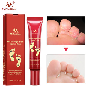 Foot Cream Herbal Anti Fungal Relieve Beriberi Cream Foot Care Treatment Skin Care Anti Fungal Infection Foot Repair Cream