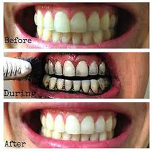 Hot Sell Tooth Cleaning Activated Charcoal Organic Coconut Shell Charcoal Bleaching Teeth Whitening Powder