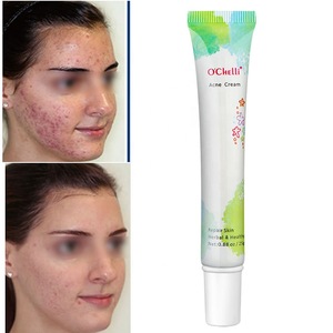 OEM/ODM 25g Ochelli Best Pimples Removal Face  Anti Acne Cream