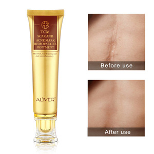 ALIWER 30ml Skin Care Dark Spot Repairing Gel Acne Mark Scar Removal Cream