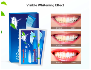 Beautiful Smile PRO White Effects Dental Whitestrips Non Peroxide Tooth Whitening Gel 3D Teeth Whitening Strips
