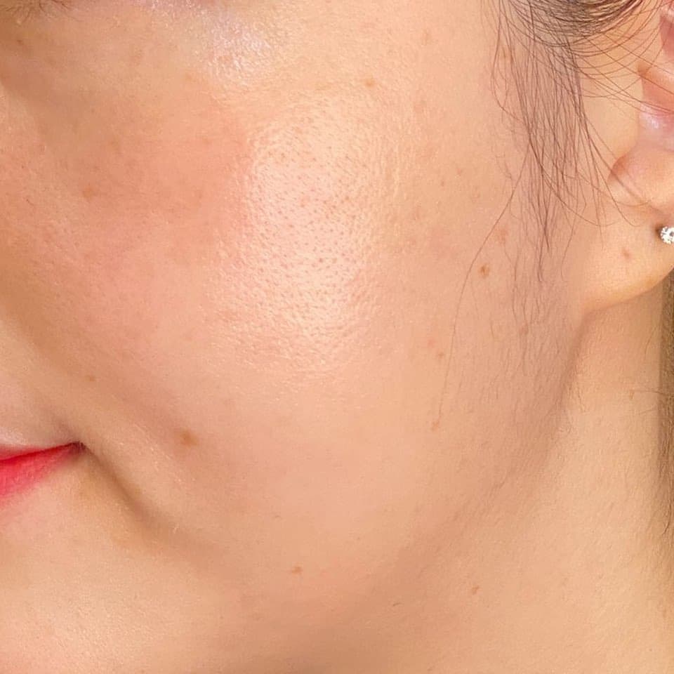 Expoliant acne anti aging brightening wrinkle essence pad 