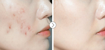 [MAY ISLAND] 7DAYS SECRET CENTELLA CICA TONER 155ml