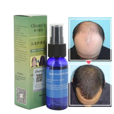 Private Label Natural Hair Growth Fluid Hormone-Free Hair Oil