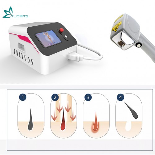 Portable Picosecond Laser / Picolaser / Pico Tattoo Removal Laser Equipment