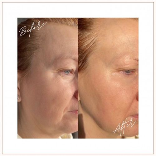 Lifting& Illuminating Eye  Cream INSTANT RESULTS