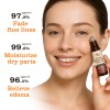 Castor Oil, Frankincense Oil, Eye Rolling Oil, Facial Dark Circles, Body Care Essence