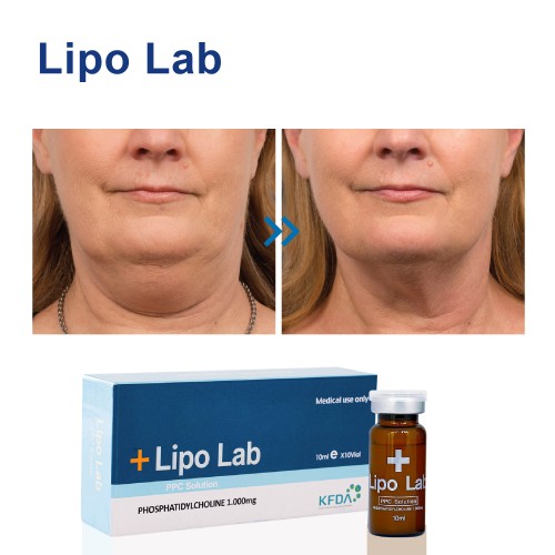 Lipo Lab Factory price slimming injection weight loss products for women