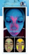 X5‑PRO AI Skin Analyzer Machine, 8 Spectrum Facial Skin & Scalp Detector