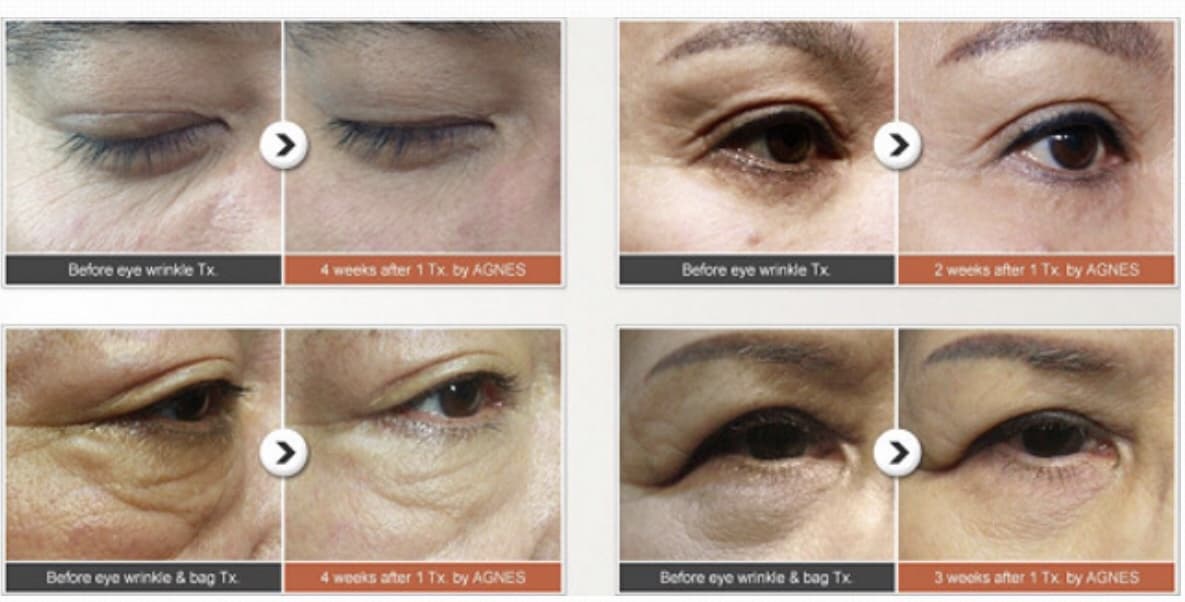 AGNES Skincare