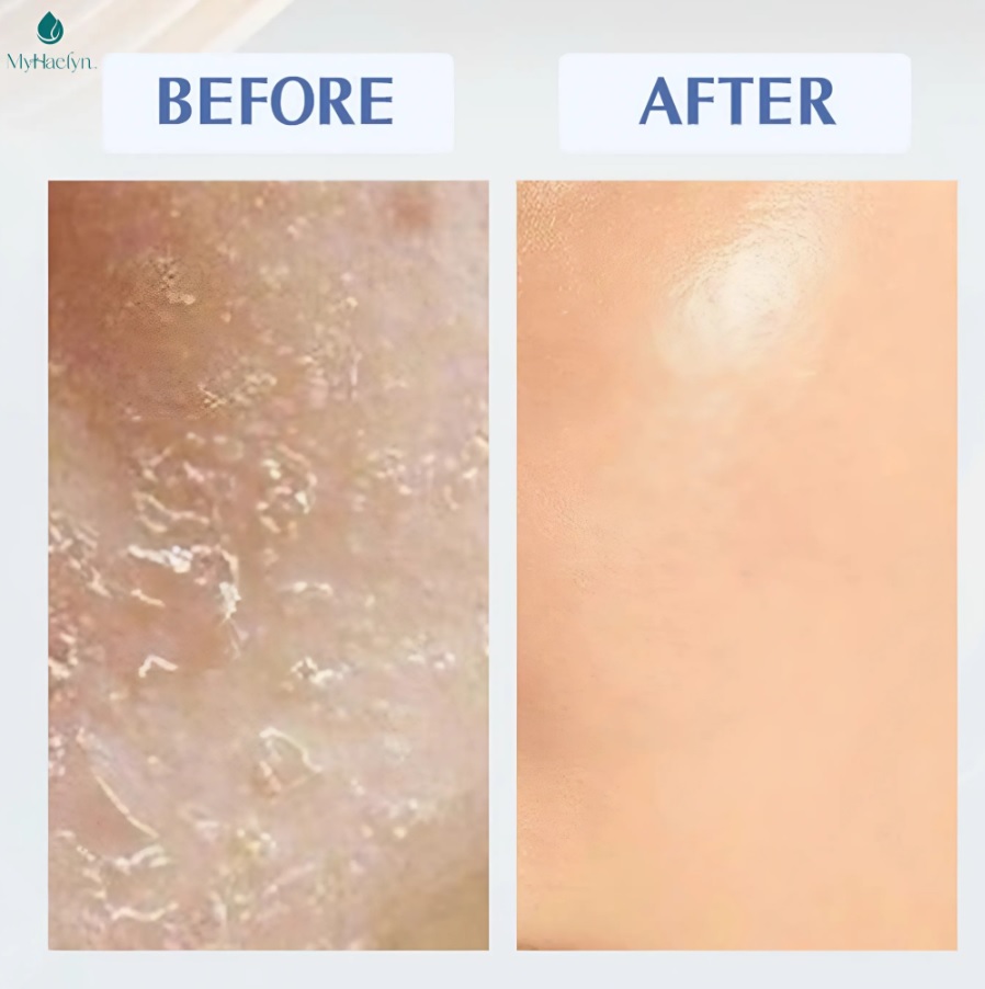 [Myhaelyn] EXO Melasla Solution Serum special tone care serum clarifies and evens out dull skin ton