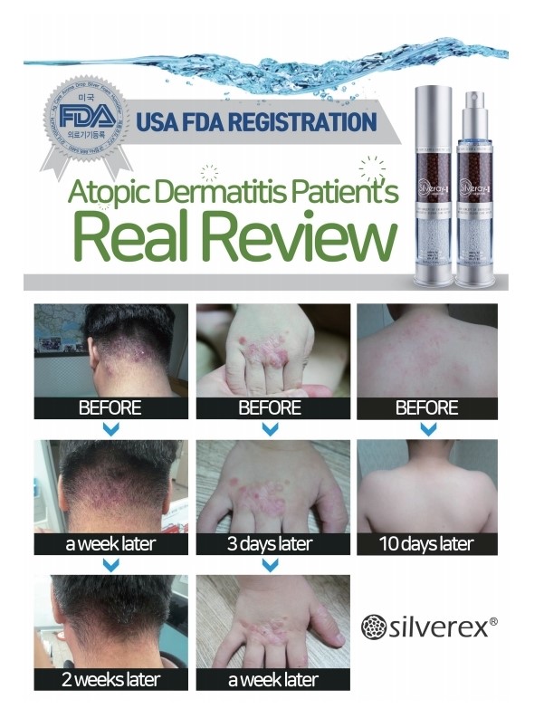 SILVEREX SILVERAY-II Sliver Ion Mist (Colloidal silver) for Sterilization and Moisturizing