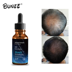 50ml OEM Hair Growth Treatment Hairs Care Biotin  Hair serum