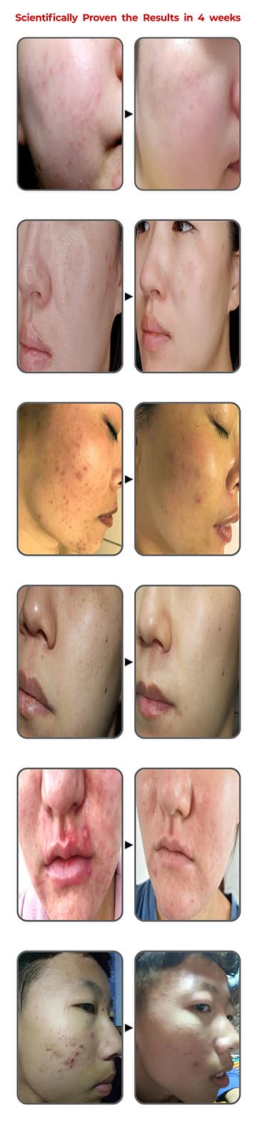 GoodDay Turmeric Mask, Whitening facial sheet, mask sheet, 