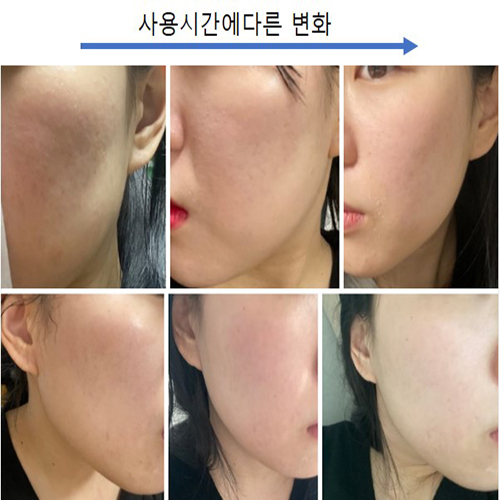 Skin Haya (functional mask pack, repeated use, whitening, elasticity, helps with skin troubles)