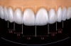 Chinese Dental Laboratory Dental lab in Shenzhen Implants dental lab