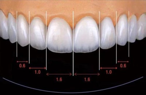 Chinese Dental Laboratory Dental lab in Shenzhen Implants dental lab