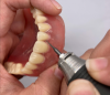 REMOVABLES | DENTURES Premier Denture