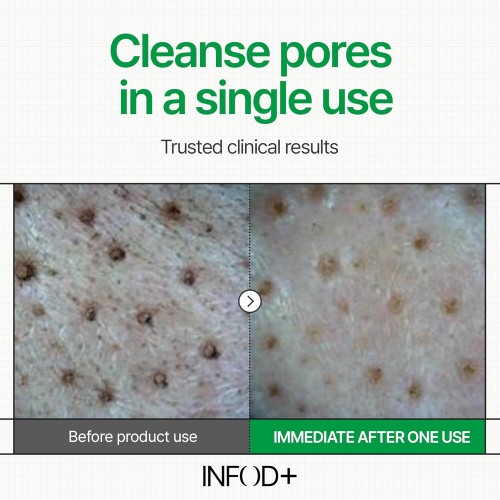 INFOD+ XCESPI316 Gel Cleanser