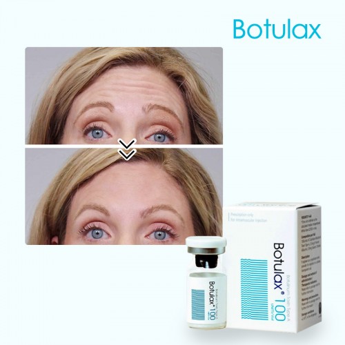 Wholesale cheap price 100 units botulium toxin in bulk Hutox injection