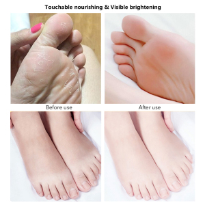 Balala 2021 new launching Private Label Jelly Foot Skin Care moisturizing foot mask