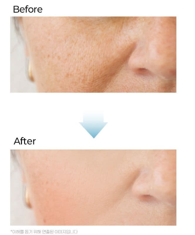 Hyaluronic Ampoule