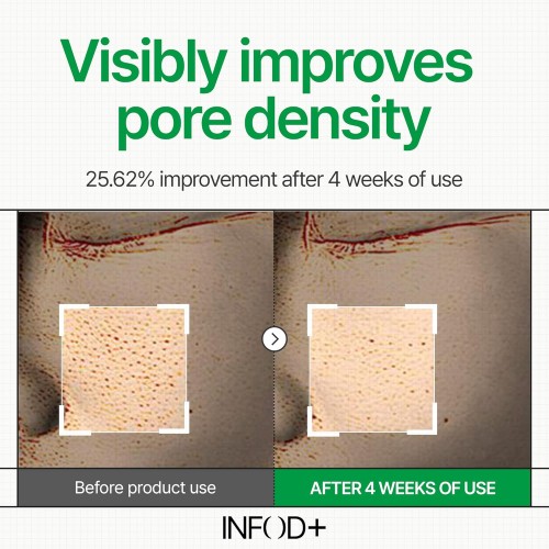 INFOD+ XCESPI316 Hydrovita Gel Pad