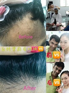 fruit vinegar black hair oil herbal black hair dye india