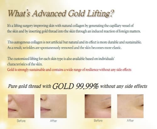 Gold Thread for beauty