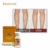 Skin Care Innotox 50u 100u Botulinum′s Toxin Type a for Face