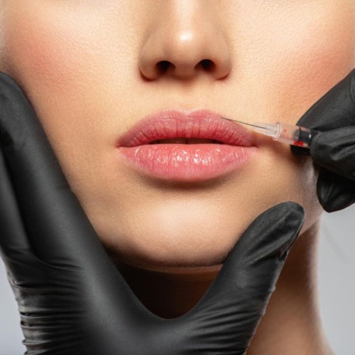 Dermal Fillers