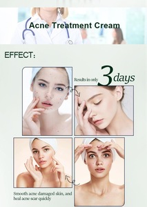 Natural Benzoyl Peroxide Fast Acne Removing 3 Days Acne Cream Treatment Acne Scar Removal Cream Gel for Skin Care