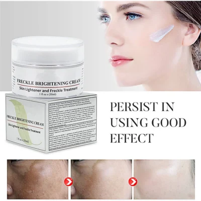 OEM Whitening Cream Freckle Remover Skin Brightening Spot Treatments Cream