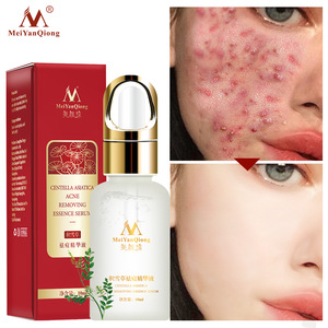 Acne removing essence serum Organic Skin Care Products Acne Scars Bio Essence Scar Removal EGF Serum