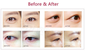 RF Eye Beauty and Skin Care Products (CE)/Eye Beauty Instrument/eye massager E160 CE certification  Eye Care System