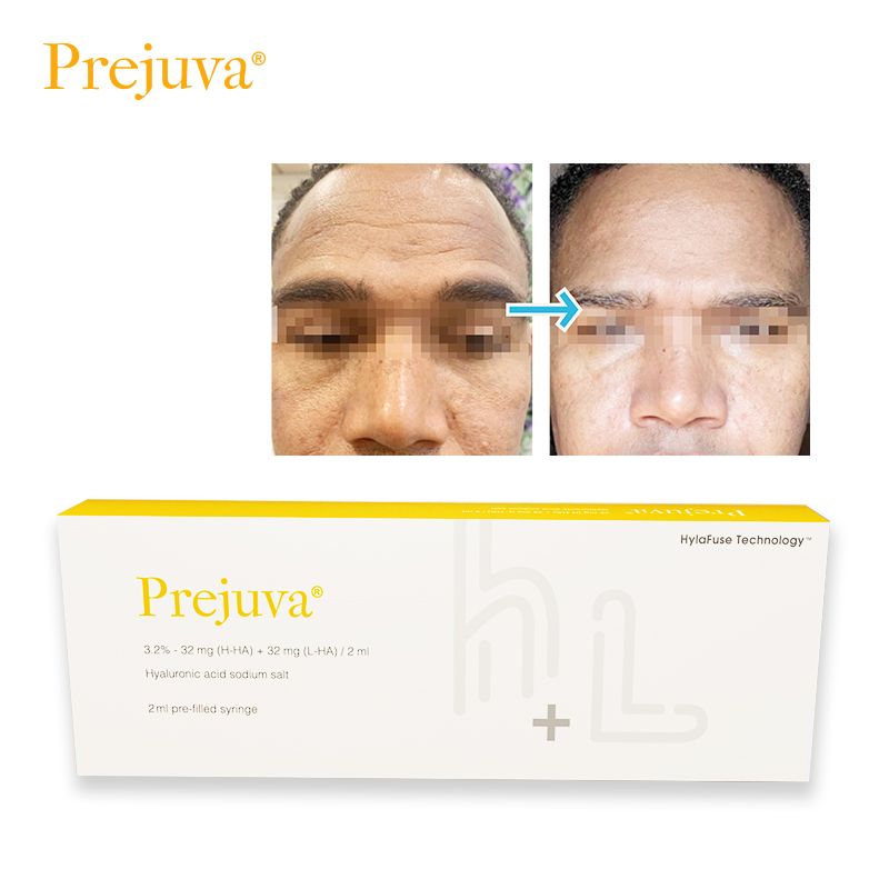 Prejuva Buy Hyaluronic Acid H L 64mg Dermal Filler Product for Face Lift