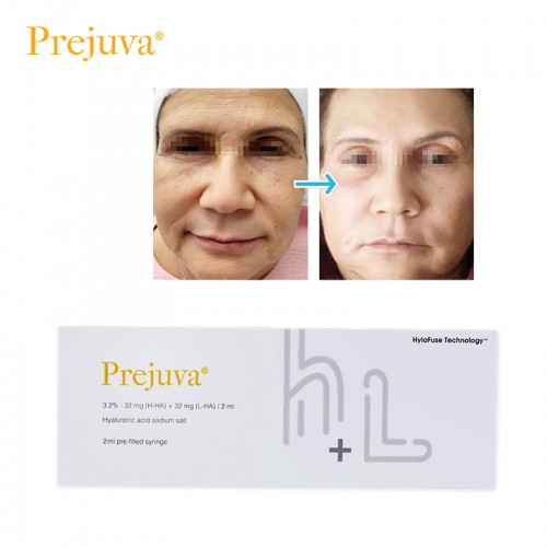 Prejuva Buy Hyaluronic Acid H L Dermal Filler Profhilo Filler Product for Face Lift