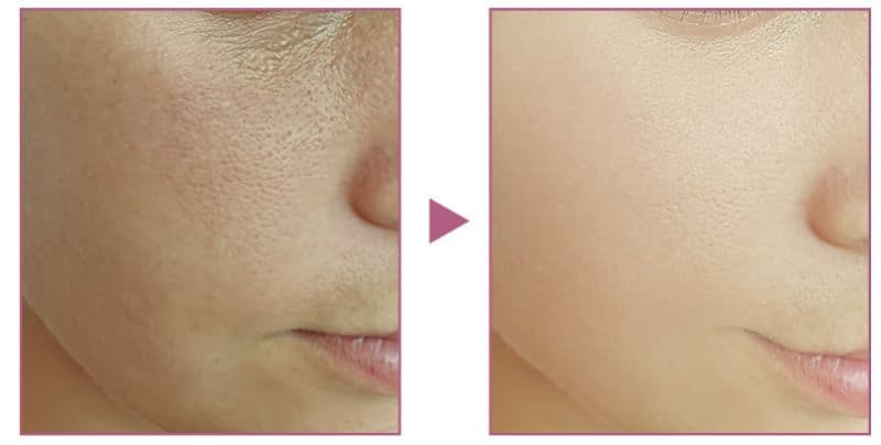 Collagen wrinkle improvement cream 