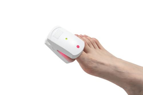 Nail Laser for Nail Fungus/Onychomycosis