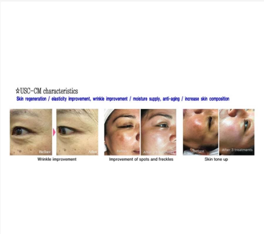 New Ampoule beauty kit