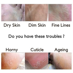 OEM ODM Peeling Feet Mask Exfoliating Socks Baby Care Pedicure Socks Remove Dead Skin Cuticles Suso Socks For Man Woman
