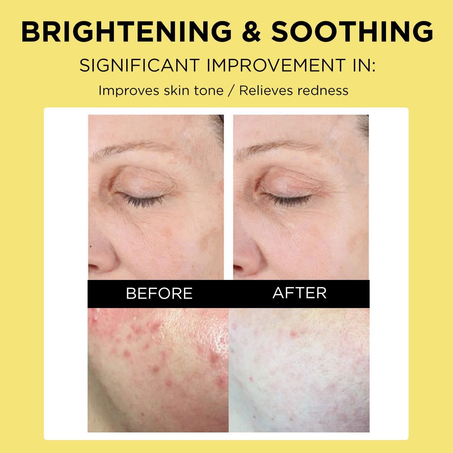 VARIHOPE 8 Days Pure Vitamin C Toner Plus